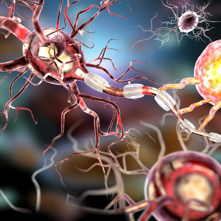 neurologie