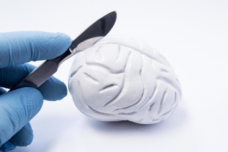 neurochirurgie